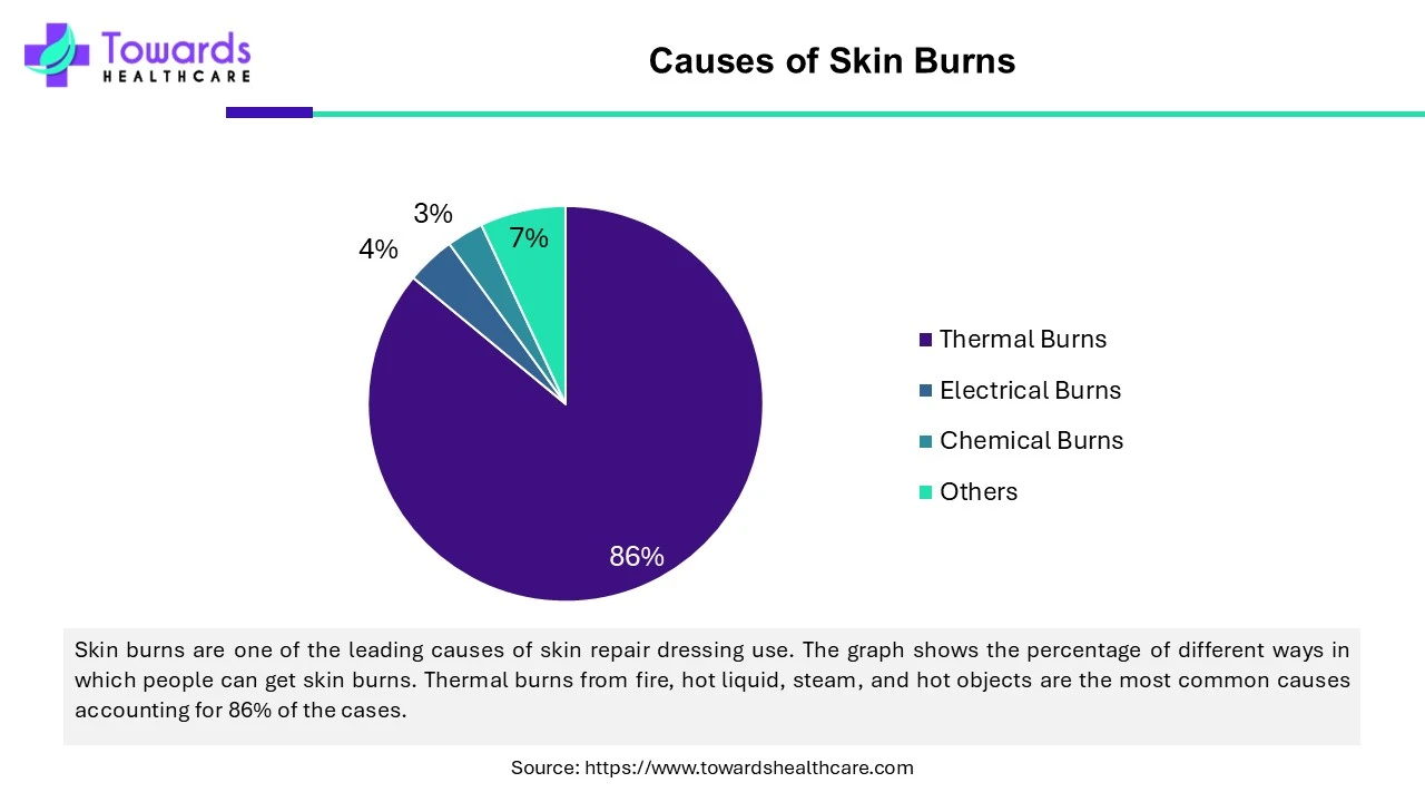 Causes of Skin Burns